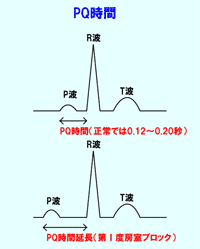 PQ時間