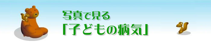 �ʐ^�Ō���u�q�ǂ��̕a�C�v
