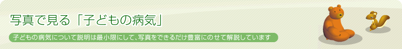 �ʐ^�摜�Ō���u�q�ǂ��̕a�C�v