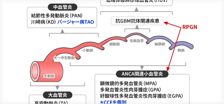 血管炎の分類