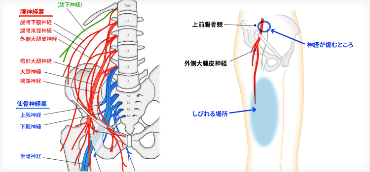 総合内科の第一歩は末梢神経を理解する≫腰仙骨神経叢