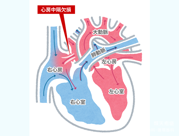 女性に多くみられる心臓・血管病変