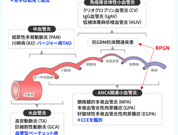 血管炎を見逃さない