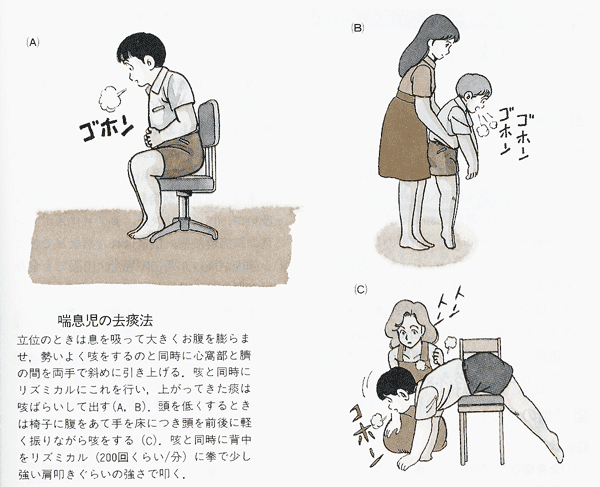 喘息の子どもの去痰法