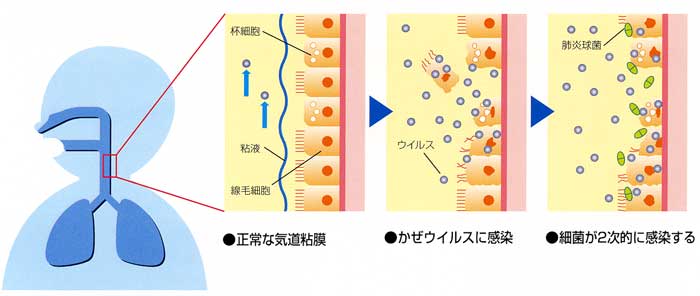 のどの粘膜の様子