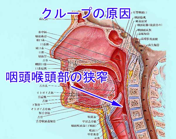 クループの原因