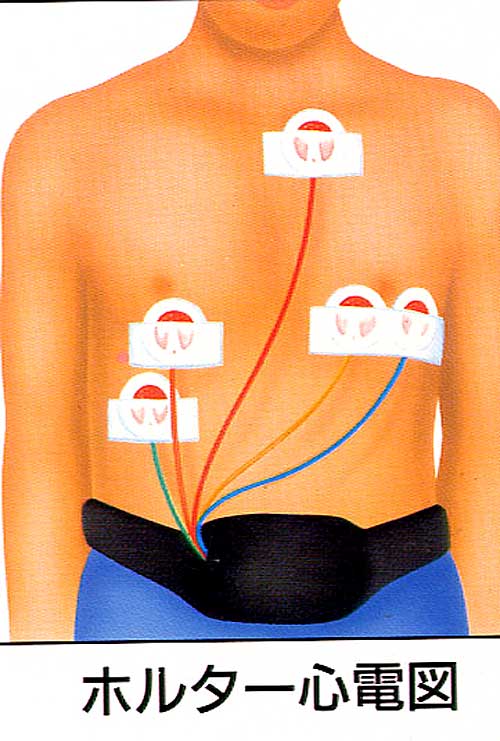 ホルター心電図