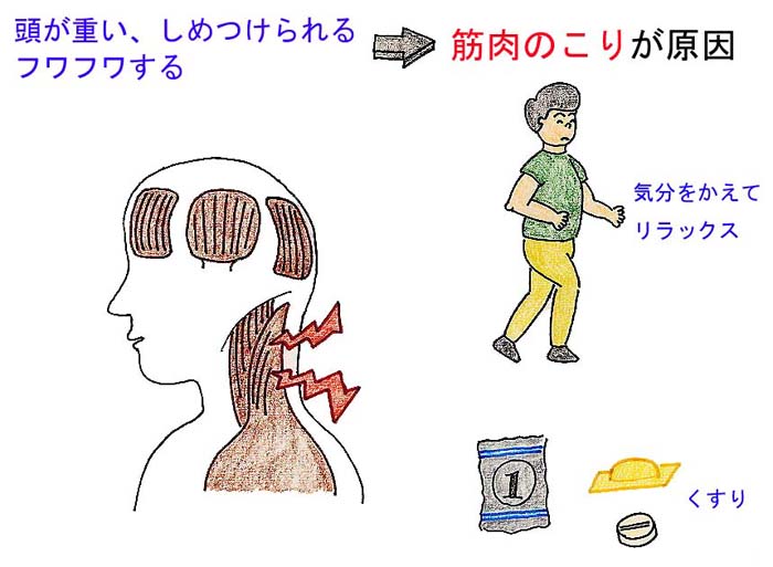 筋緊張（こり）によるふわふわ感