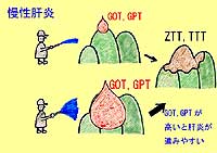 肝機能障害