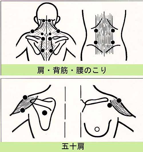 肩こりがひどくなると・・・