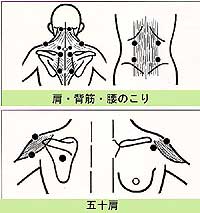 肩こり