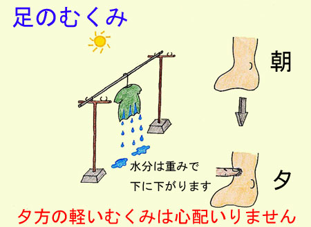 むくみ 浮腫 診察室でよくみる大人の病気 みやけ内科 循環器科 院長ブログ