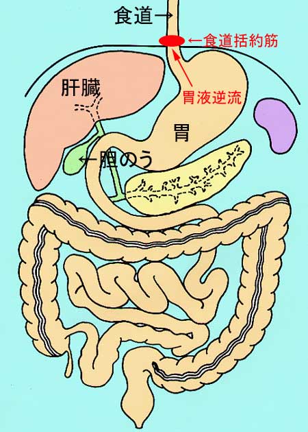 胸やけ、げっぷ