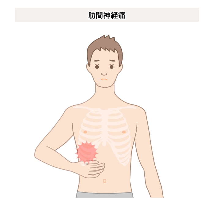 肋間神経痛