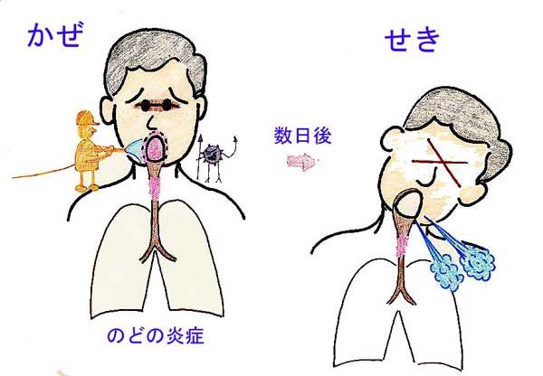 気圧 の 変化 咳