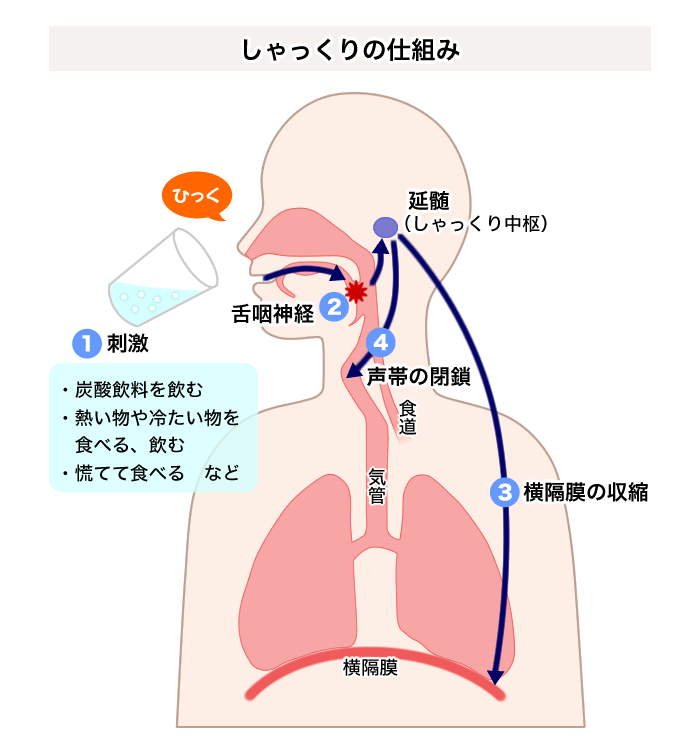 即効 方 しゃっくり 止め