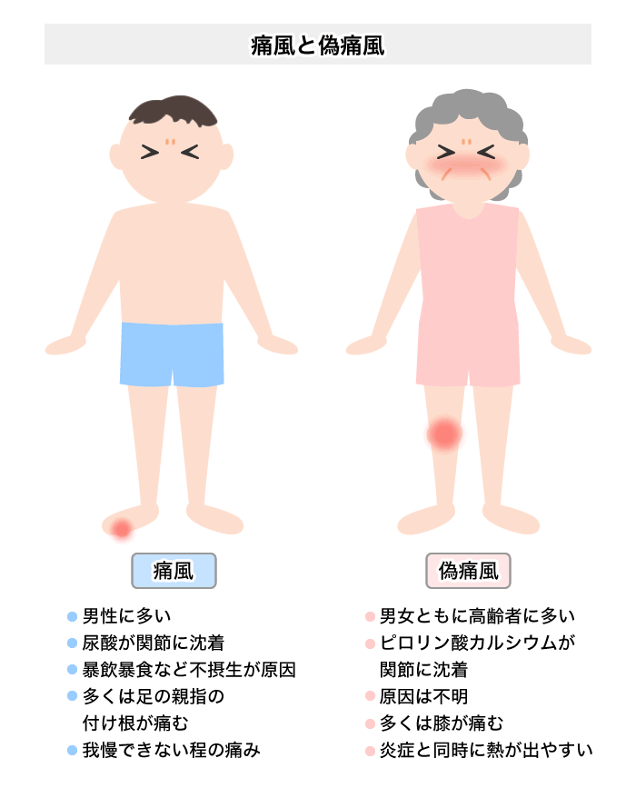 痛風と偽痛風