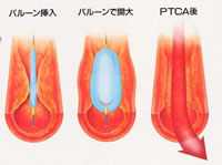 前へ