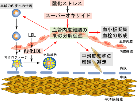 7 プラークの安定化 内皮細胞由来no 分かりやすい動脈硬化 心臓 血管の話 みやけ内科 循環器科 院長ブログ