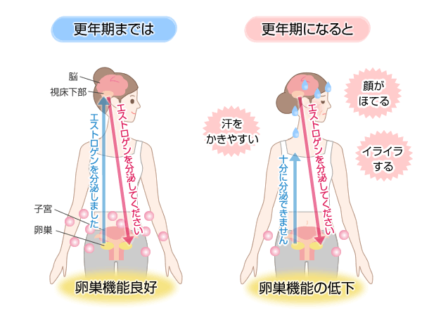 女性の心臓病の特徴更年期障害とは｜女性と心臓・血管の病気｜心臓・血管の話 みやけ内科・循環器科