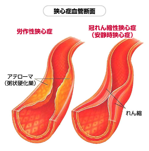 次へ