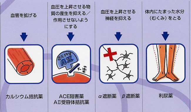 【イラスト2】使用されている降圧薬は大きく分けると4グループあります。