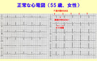 前へ