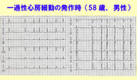 前へ