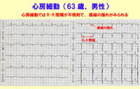 次へ