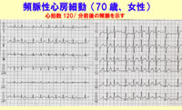 前へ