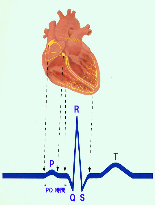 心電図の波形