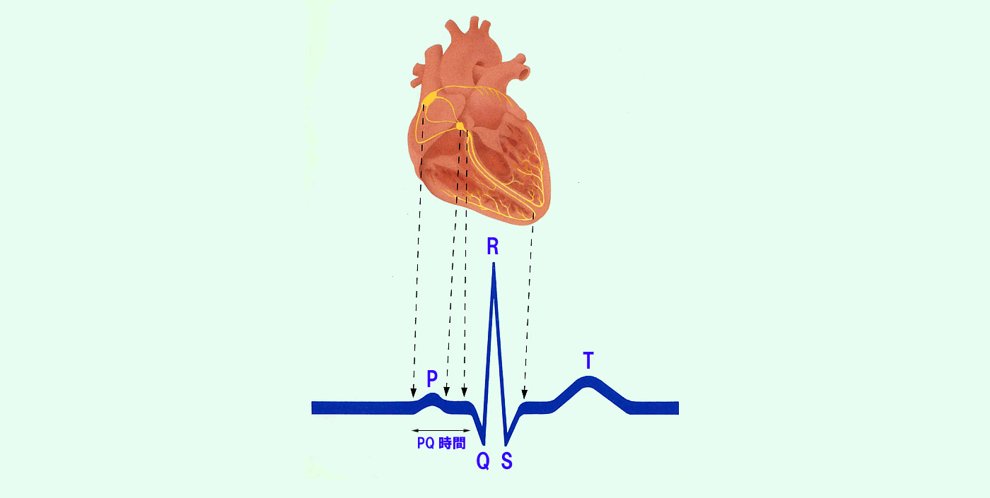 誰でも分かる「心電図の簡単な読み方」