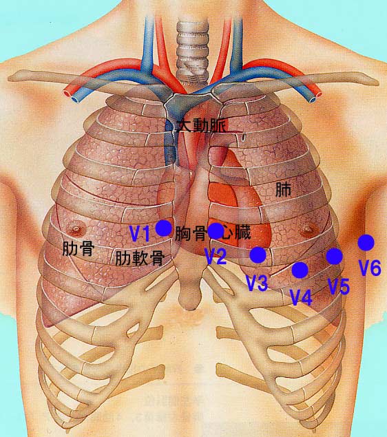 右からV1から順にV6まで心臓を水平方向に場所を変えながら心電図を記録します。