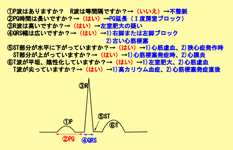 9 実際の心電図を読むためのフローチャート 誰でも分かる 心電図の