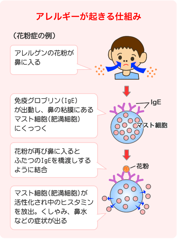 アレルギーが起きる仕組み