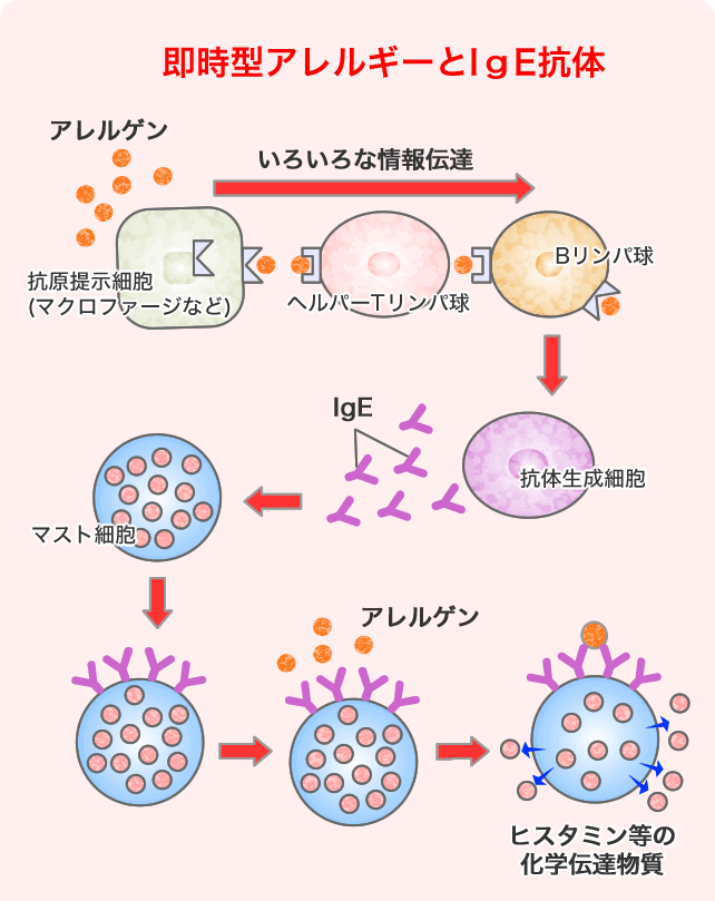 即時型アレルギーとIgE抗体