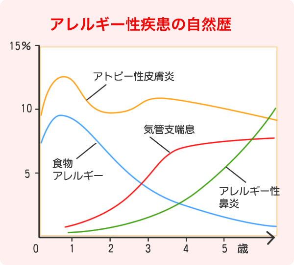 アレルギー疾患の自然歴