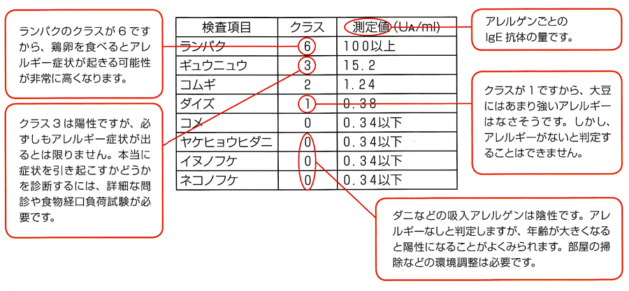 ImmunoCAPの結果の見方