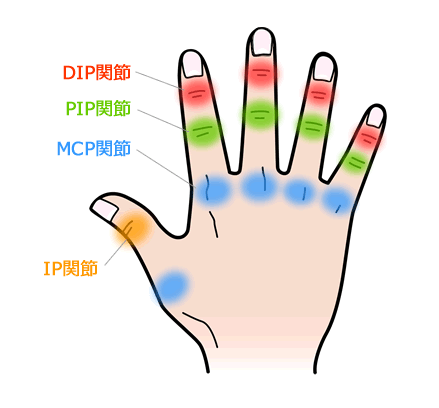 （MCP、PIP、DIP関節とは） 