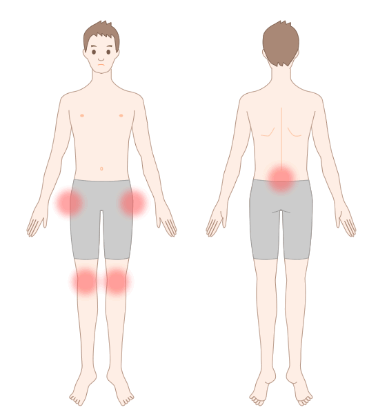 骨軟化症で生じる痛みの部位