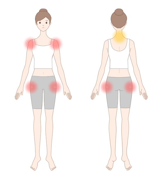 リウマチ性多発筋痛症で生じる痛みの部位（※赤丸は主な関節痛の部位） 
