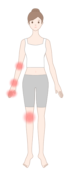 膠原病で生じる痛みの部位