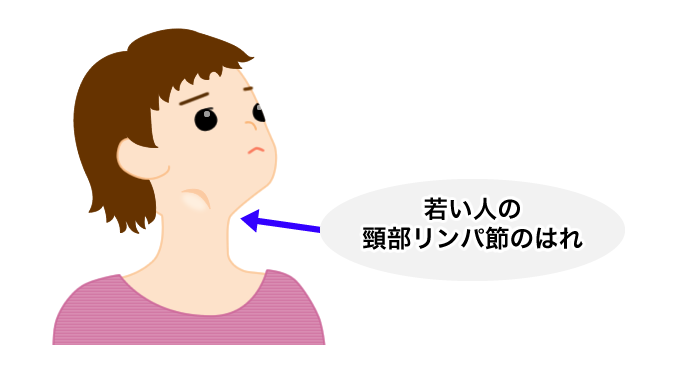 節 腫脹 リンパ 頚部 頸部リンパ節が腫れる原因は？首にしこりや腫れ、痛みがみられる病気を解説｜医療法人あだち耳鼻咽喉科