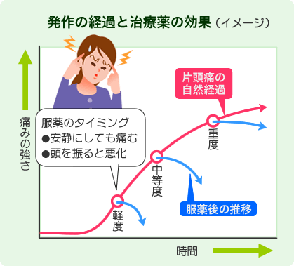 「頭痛」の診察のポイント