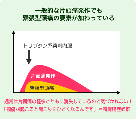 一般的な片頭痛発作でも緊張型頭痛の要素が加わっている