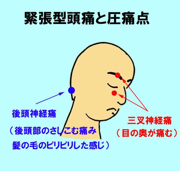 肩こり関連症候群 とは 1 町医者の診療メモ みやけ内科 循環器科