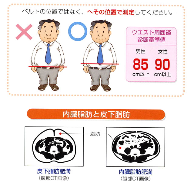 内臓脂肪とメタボリックシンドローム ポッコリおなかの人は要注意 みやけ内科 循環器科