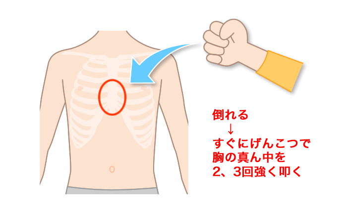 意識を失って倒れる→すぐにげんこつで胸の真ん中を2、3回強く叩く