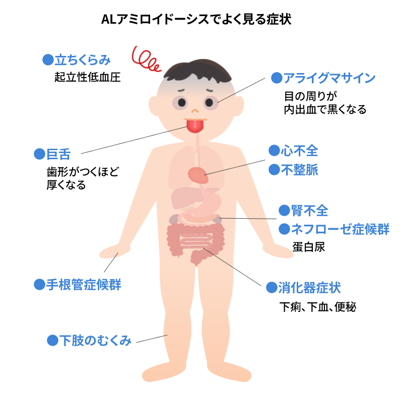 アミロイドーシスの診断