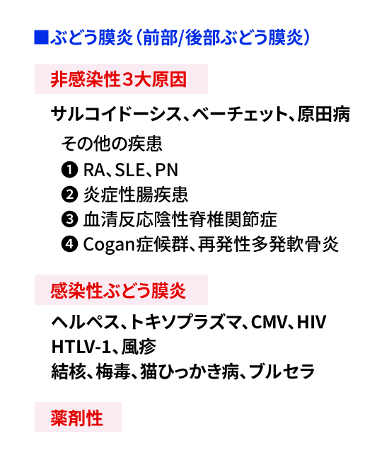 ぶどう膜炎（前部/後部ぶどう膜炎）